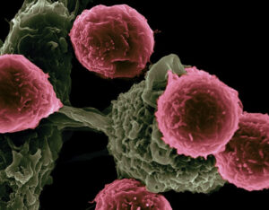 Cancer cells